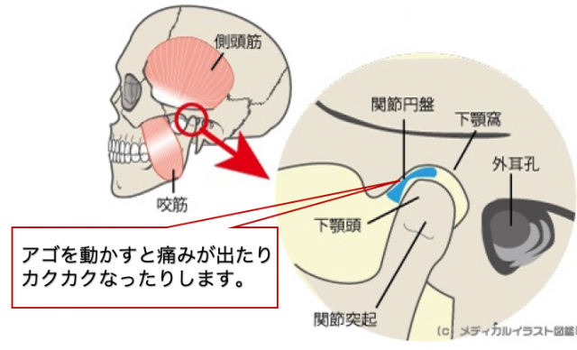 顎関節