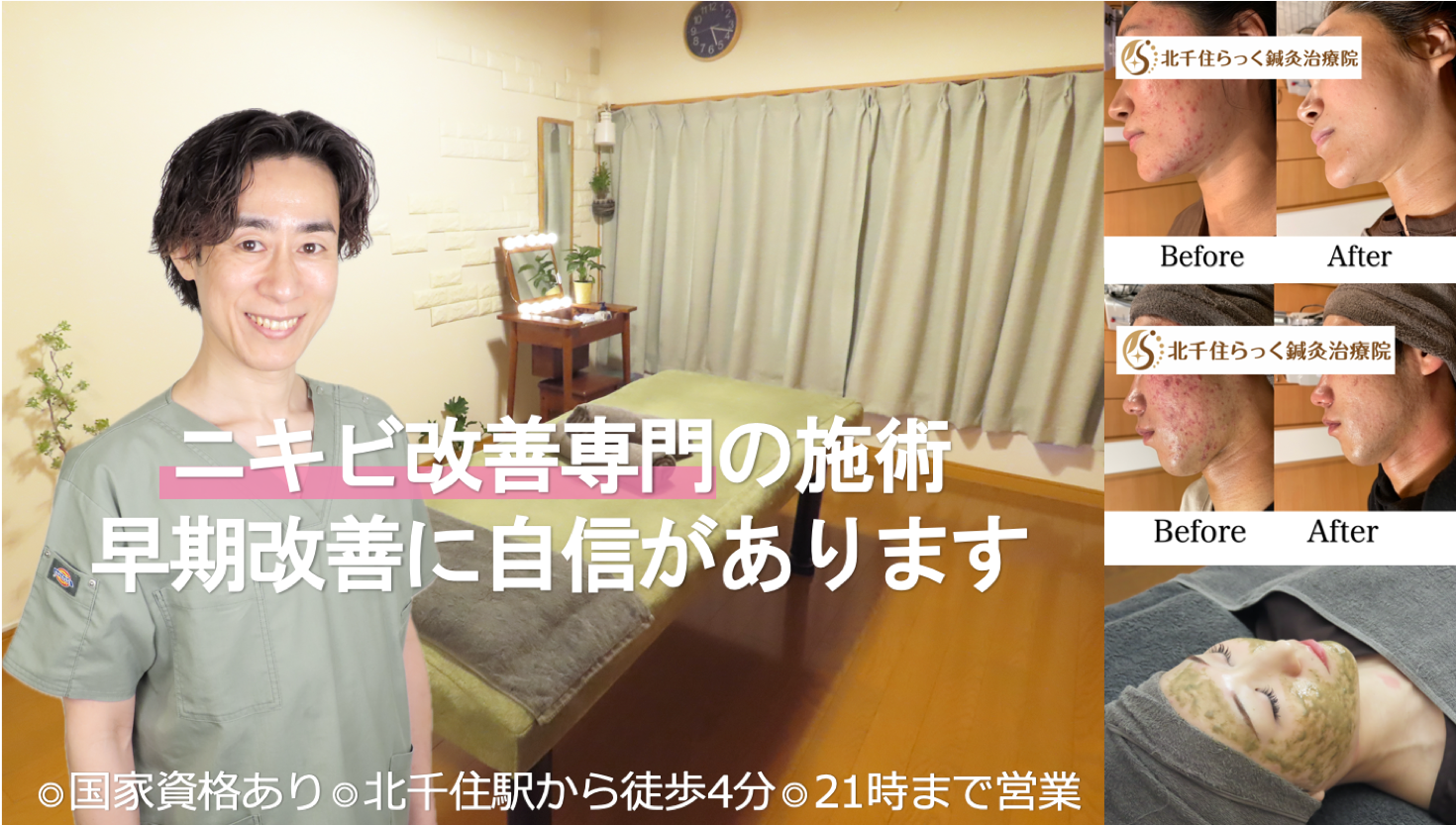 ニキビ吹き出物