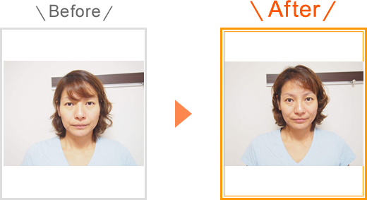 ビフォーアフター