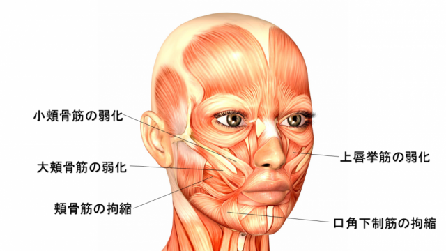 口角下端の