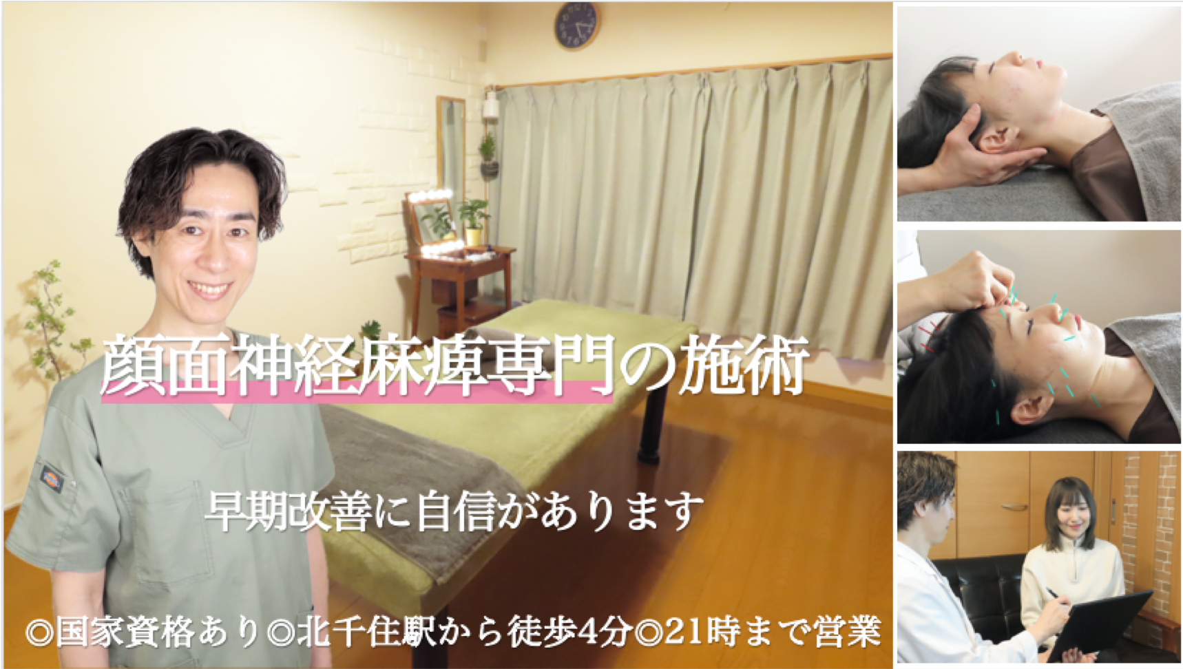 顔面神経麻痺