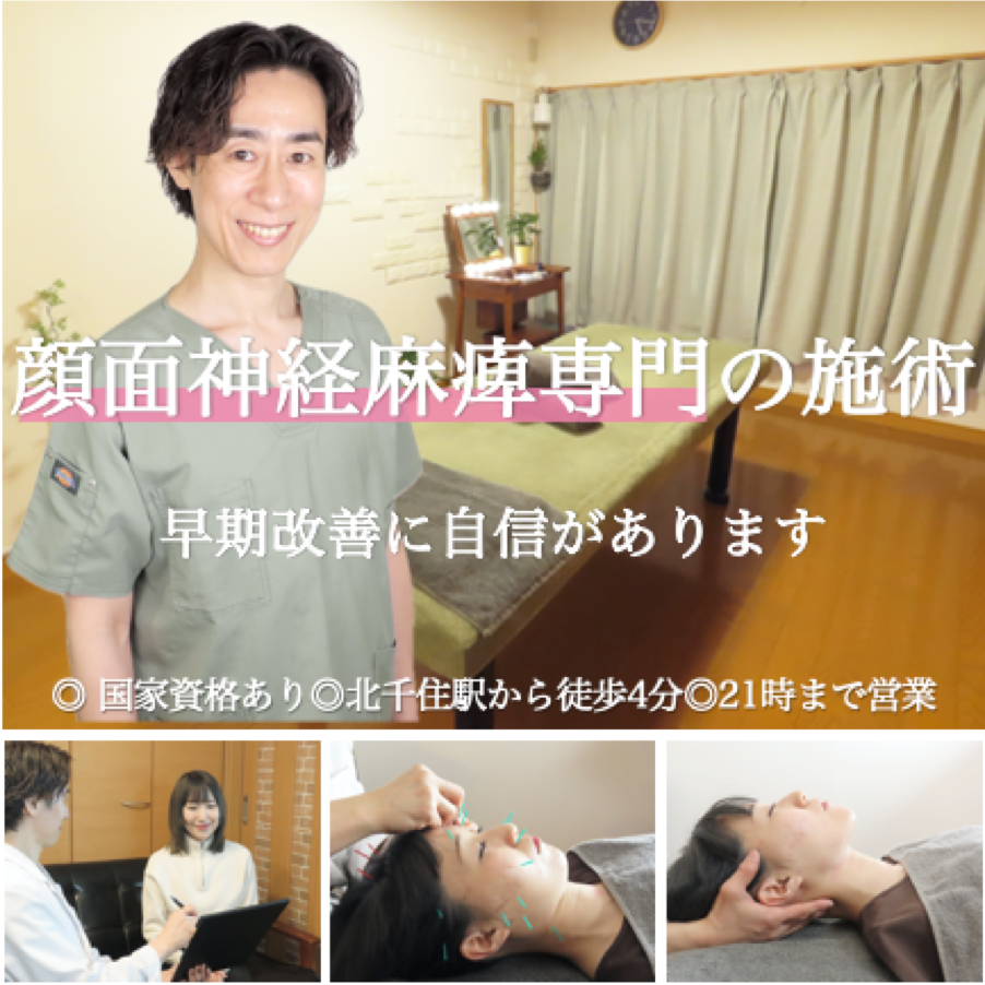 顔面神経麻痺