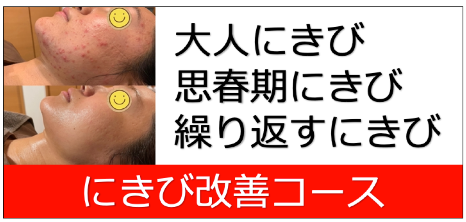 ニキビ改善コース